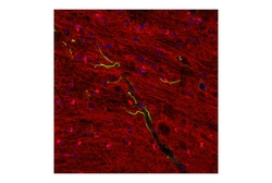 Cell Signaling Technology&nbsp;Tau D1M9X XPR Rabbit mAb