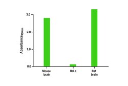 Cell Signaling Technology&nbsp;Total Neurofilament-L Matched