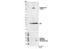 Cell Signaling Technology&nbsp;Phospho-p53 Thr81 Antibody 2