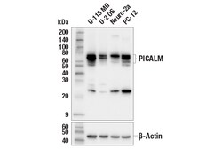 Cell Signaling Technology&nbsp;PICALM E3J9R Rabbit mAb 100