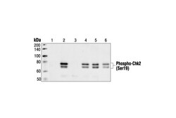 Cell Signaling Technology&nbsp;Phospho-Chk2 Ser19 Antibody