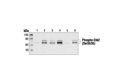 Cell Signaling Technology&nbsp;Phospho-Chk2 Ser33/35 Antibo