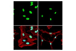 Cell Signaling Technology Ubiquityl-Histone H2A Lys119