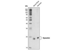 Cell Signaling Technology&nbsp;alpha/beta-Synuclein Syn205