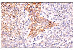 Cell Signaling Technology&nbsp;MT1-MMP E3S5S Rabbit mAb 100