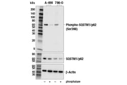 Cell Signaling Technology&nbsp;Phospho-SQSTM1/p62 Ser366 An