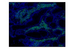 Cell Signaling Technology CD38 E7Z8C XPR Rabbit mAb