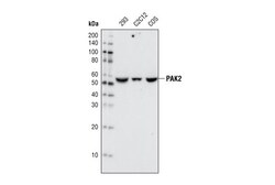 Cell Signaling Technology&nbsp;PAK2 C17A10 Rabbit mAb 20 ul