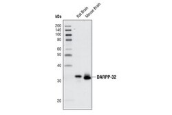 Cell Signaling Technology DARPP-32 19A3 Rabbit mAb BS