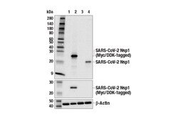 Cell Signaling Technology&nbsp;SARS-CoV-2 Nsp1 E3P2T Rabbit