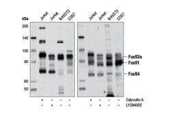 Cell Signaling Technology&nbsp;Phospho-FoxO1 Thr24/FoxO3a