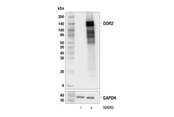Cell Signaling Technology&nbsp;DDR2 E6V2N Rabbit mAb 100 ul