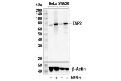 Cell Signaling Technology&nbsp;TAP2 E8G5I Rabbit mAb 100 ul