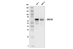 Cell Signaling Technology&nbsp;MEF2D E9R5J Rabbit mAb 100 u