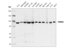 Cell Signaling Technology&nbsp;PSMD2 D6W7G Rabbit mAb 100 u
