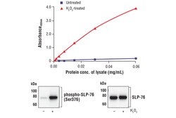 Cell Signaling Technology FastScantm Phospho-SLP-76 S