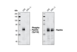 Cell Signaling Technology&nbsp;Phospho-Paxillin Tyr118 Anti