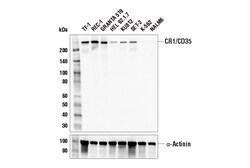 Cell Signaling Technology&nbsp;CR1/CD35 E8S3X Rabbit mAb 10