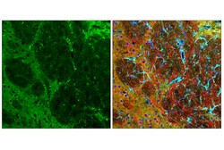 Cell Signaling Technology&nbsp;Phospho-Tau Thr205 E8Q5Z M