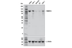 Cell Signaling Technology&nbsp;RBM15 Antibody 100 ul