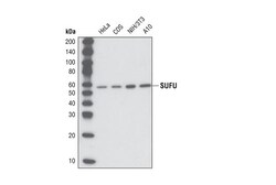 Cell Signaling Technology&nbsp;SUFU C54G2 Rabbit mAb 20 ul