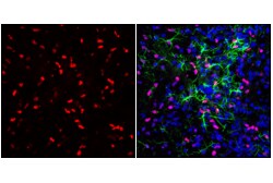Cell Signaling Technology Olig2 E6G6Q XPR Rabbit mAb