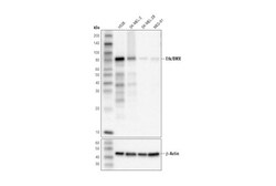 Cell Signaling Technology&nbsp;Etk/BMX D6J1S Rabbit mAb 100