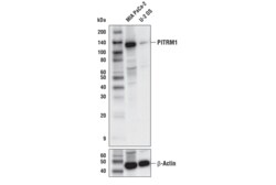 Cell Signaling Technology&nbsp;PITRM1 Antibody 100 ul