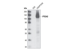 Cell Signaling Technology&nbsp;PTCH2 G1191 Antibody 20 ul