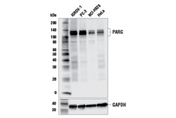 Cell Signaling Technology&nbsp;PARG E9R4G Rabbit mAb 100 ul