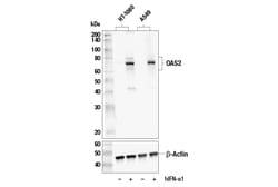 Cell Signaling Technology&nbsp;OAS2 E2G4K Rabbit mAb 100 ul