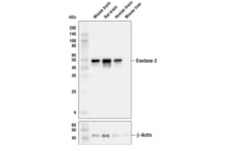 Cell Signaling Technology&nbsp;Enolase-2 E2H9X XPR Rabbit