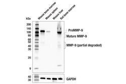 Cell Signaling Technology&nbsp;MMP-9 E7N3Y Rabbit mAb 100 u