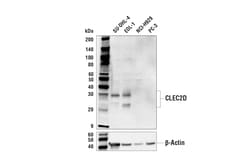 Cell Signaling Technology&nbsp;CLEC2D E4K1H Rabbit mAb 100