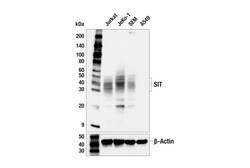 Cell Signaling Technology&nbsp;SIT Antibody 100 ul
