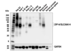 Cell Signaling Technology&nbsp;ZIP14/SLC39A14 E3H7D Rabbit