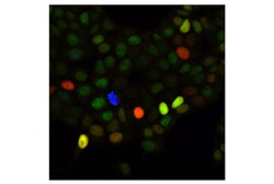Cell Signaling Technology&nbsp;CDK4 D9G3E Rabbit mAb BSA a