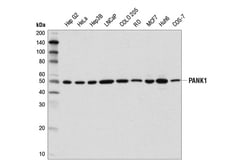 Cell Signaling Technology&nbsp;PANK1 D2W3N Rabbit mAb 100 u