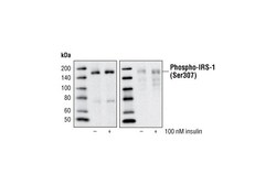 Cell Signaling Technology&nbsp;Phospho-IRS-1 Ser307 Antibod