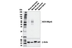 Cell Signaling Technology&nbsp;NCR1/NKp46 E2K4N Rabbit mAb