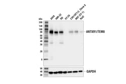 Cell Signaling Technology&nbsp;ANTXR1/TEM8 Antibody 100 ul
