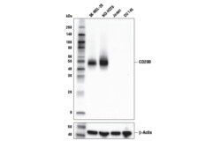 Cell Signaling Technology&nbsp;CD200 E5I9V XPR Rabbit mAb