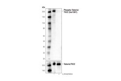 Cell Signaling Technology&nbsp;Phospho-Tuberin/TSC2 Ser1387