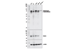 Cell Signaling Technology&nbsp;Merlin/Ezrin/Radixin/Moesin D