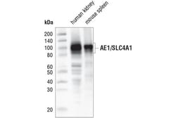 Cell Signaling Technology&nbsp;AE1/SLC4A1 D3X1R Rabbit mAb
