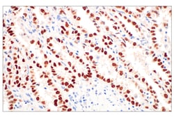 Cell Signaling Technology&nbsp;Thyroid Transcription Factor 1