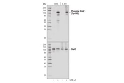 Cell Signaling Technology&nbsp;Phospho-Stat2 Tyr690 D3P2P