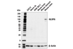 Cell Signaling Technology&nbsp;NLRP6 F8J8R Rabbit mAb 100 u