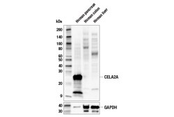 Cell Signaling Technology&nbsp;CELA2A E1D6G Rabbit mAb 100