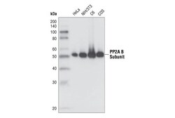 Cell Signaling Technology&nbsp;PP2A B Subunit 100C1 Rabbit